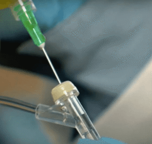 Understanding Y Port IV Tubing and Its Clinical Function