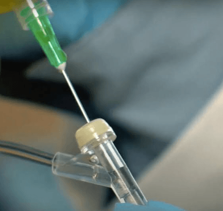 Understanding Y Port IV Tubing and Its Clinical Function